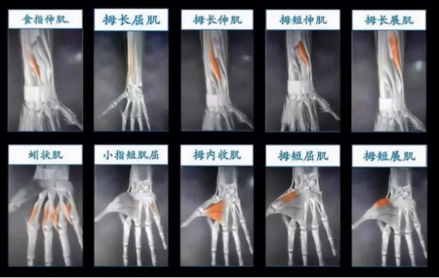 手腕发力怎样变？避免动作过大的技巧